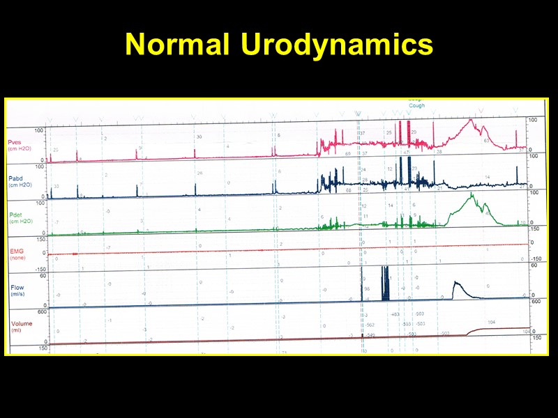 Normal Urodynamics